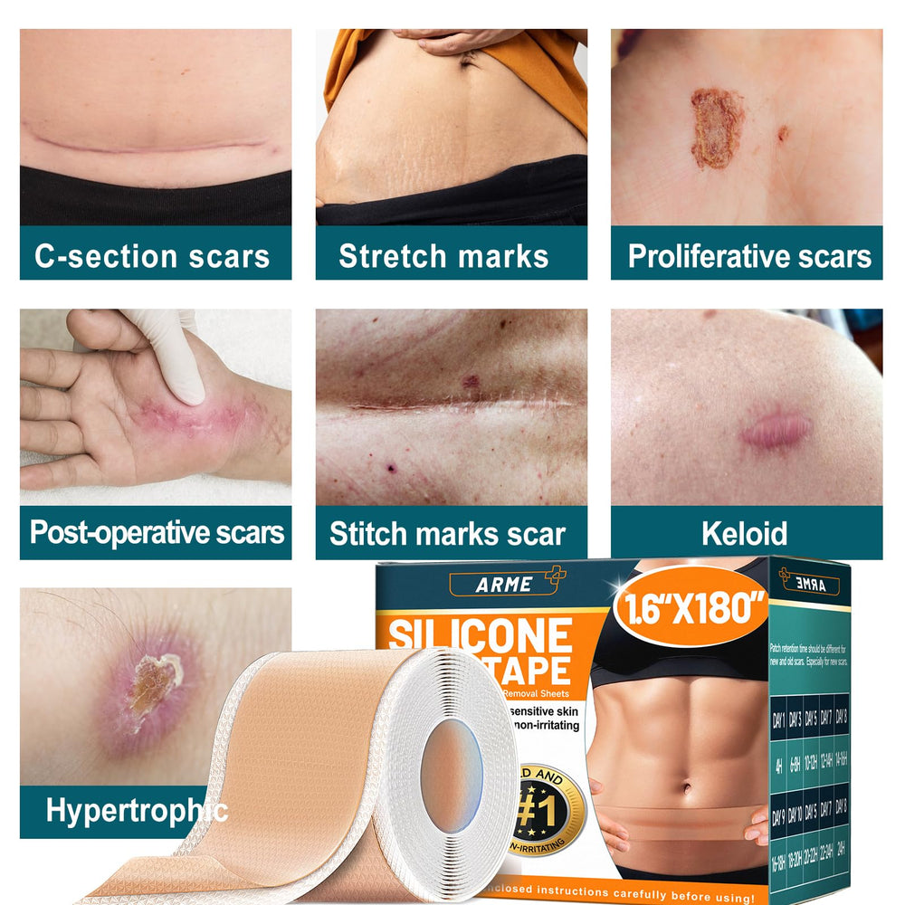 Arme silicone scar tape clean removal leaves no sticky residue.
