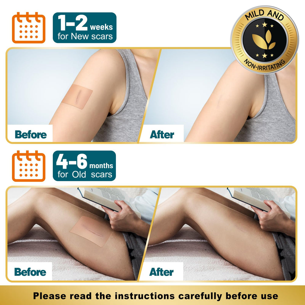 Arme scar tape features skin-friendly material for sensitive areas and longer wear.