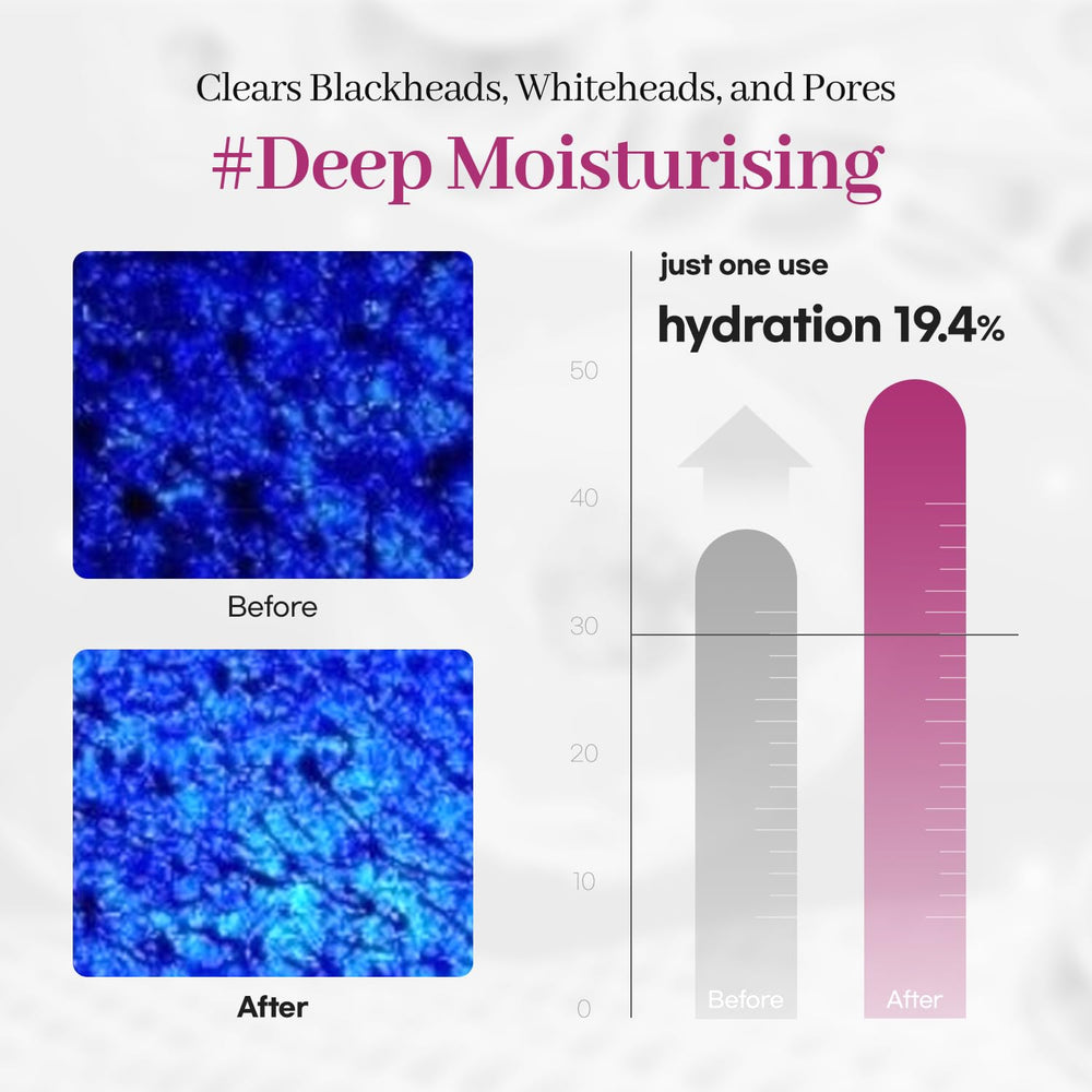 AROCELL OFFICIAL close-up pore-care scene hints at blackhead reduction possibilities.