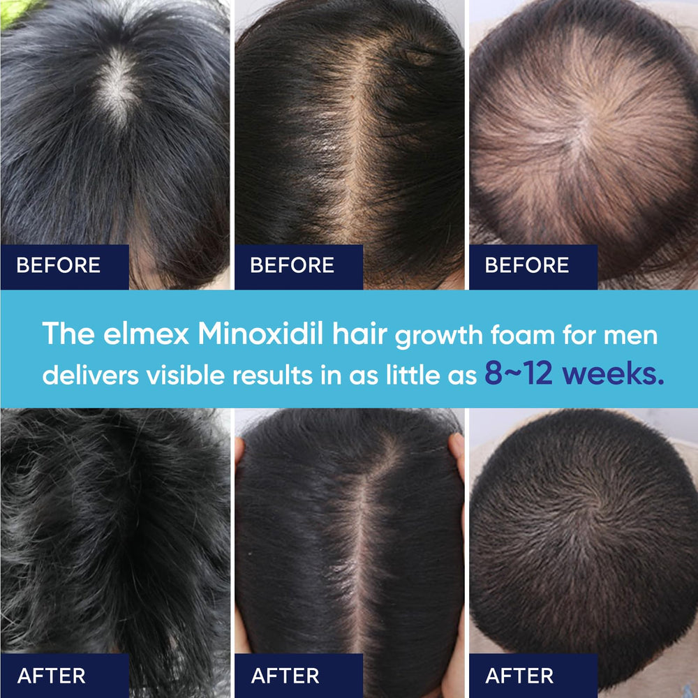 Artimore Minoxidil Foam packaging box for home use.