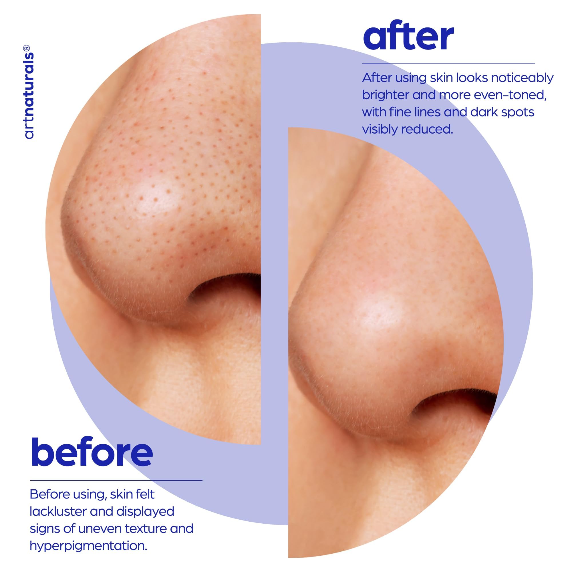 Artnaturals Glycolic Serum packaging with vegan and nighttime hints