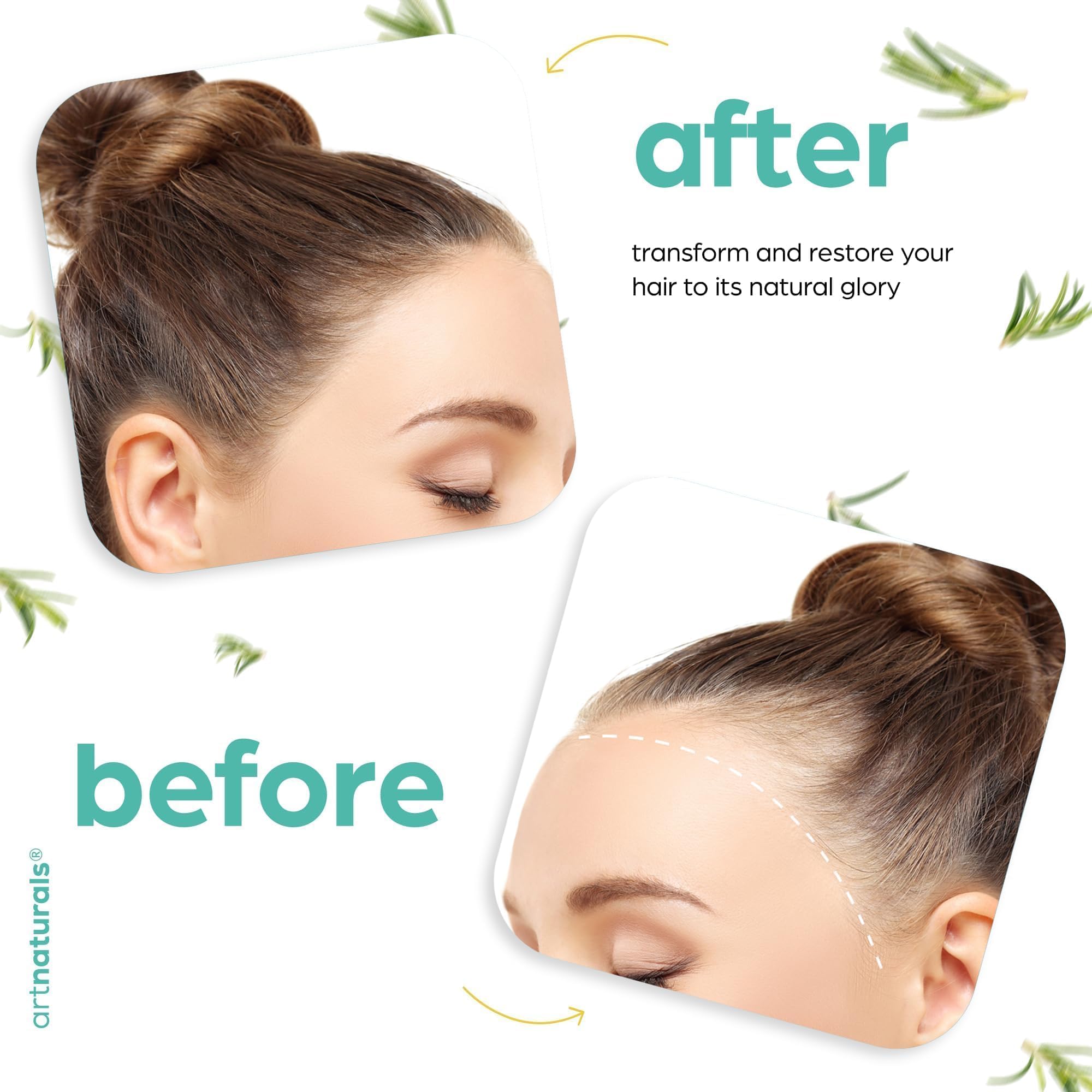 Artnaturals massager in use to distribute oil across scalp.