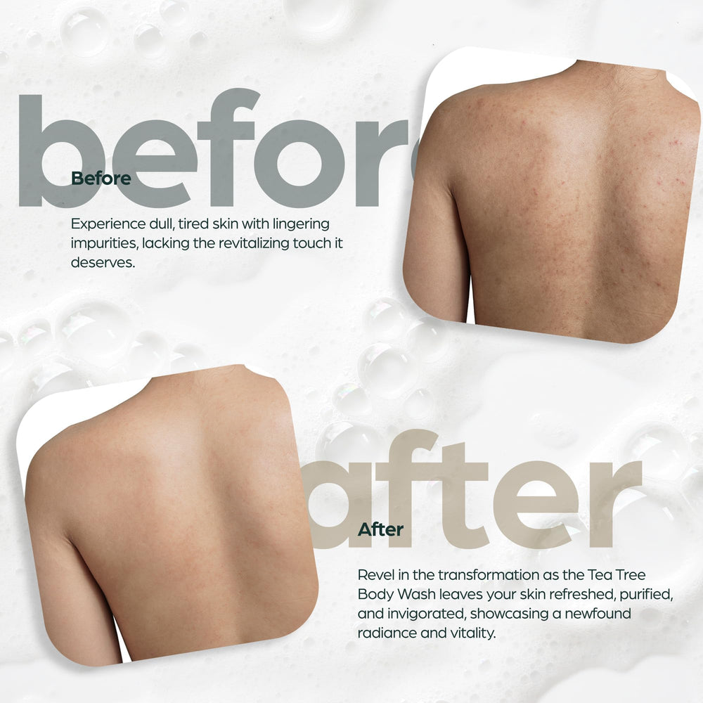 Artnaturals Tea Tree Oil Body Wash ingredients highlight Australian tea tree oil.