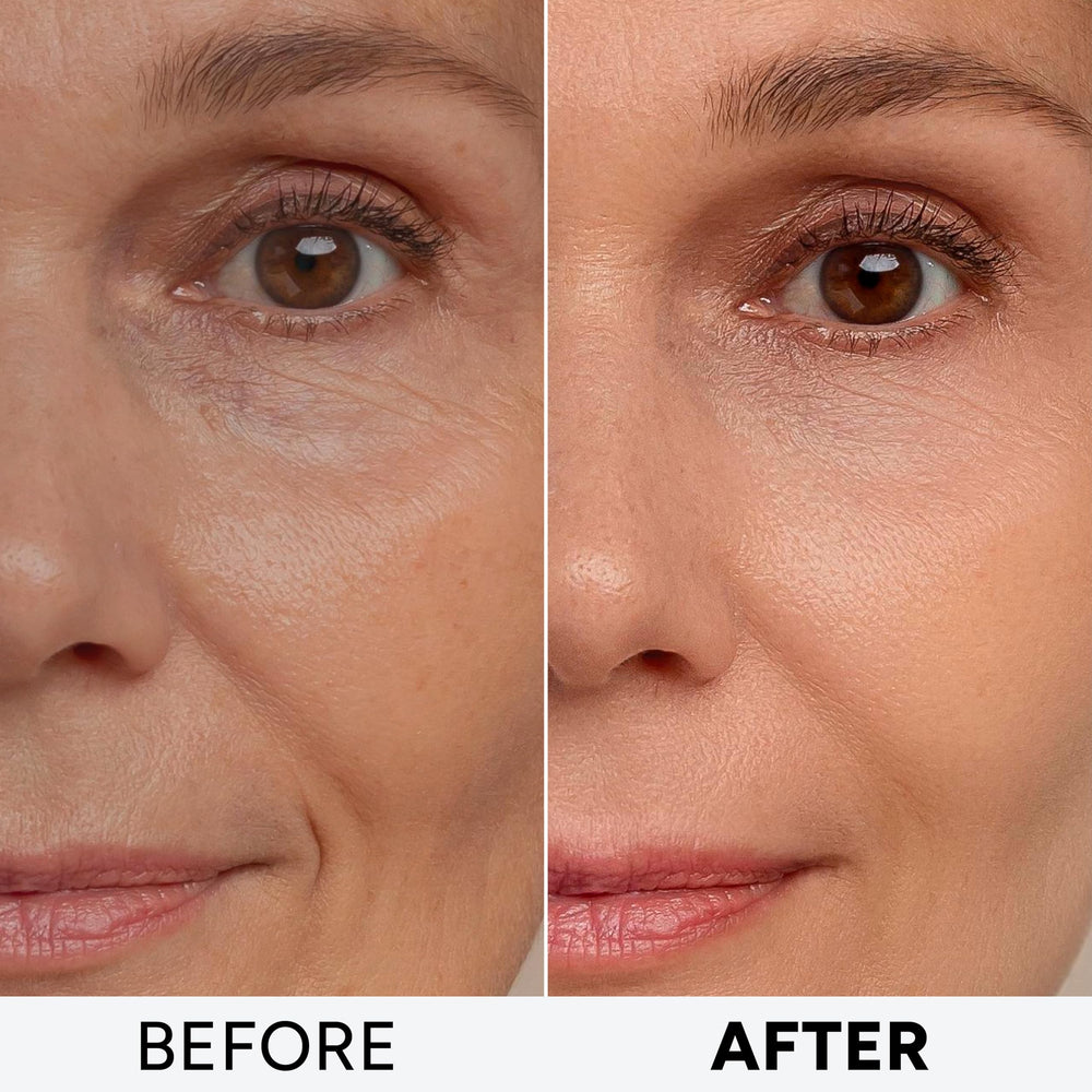 Arvesa Retinol Cream for Face – Collagen & Hyaluronic Acid Anti
