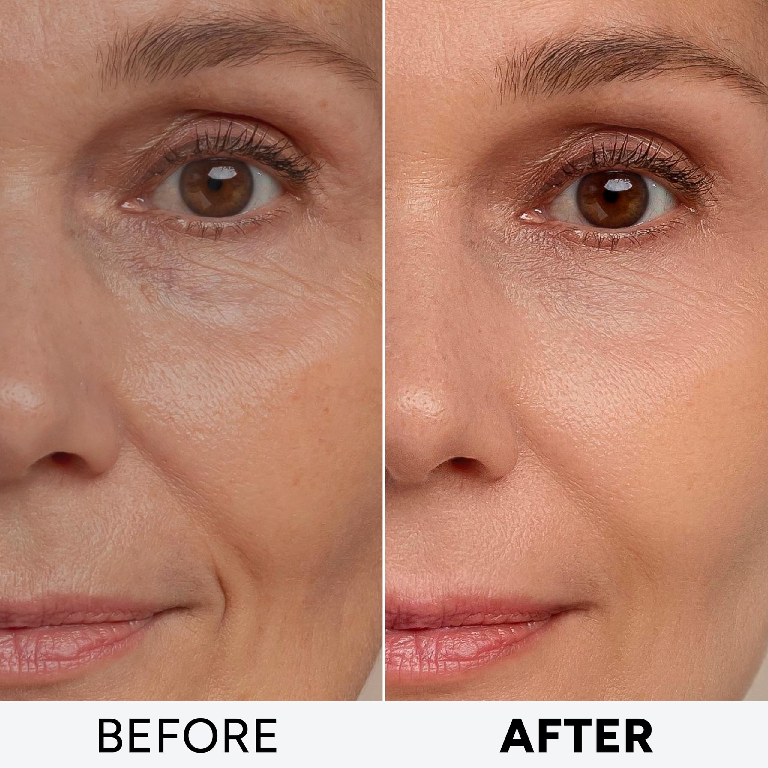 Arvesa Retinol Cream neck-decollete application ready for firming care