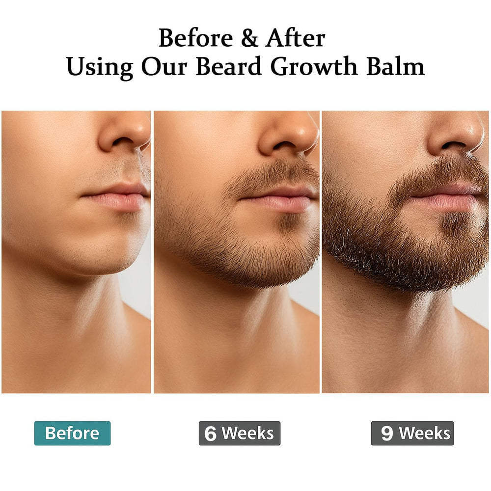 A.SelecVibe Apolo beard growth visualization suggesting fuller appearance