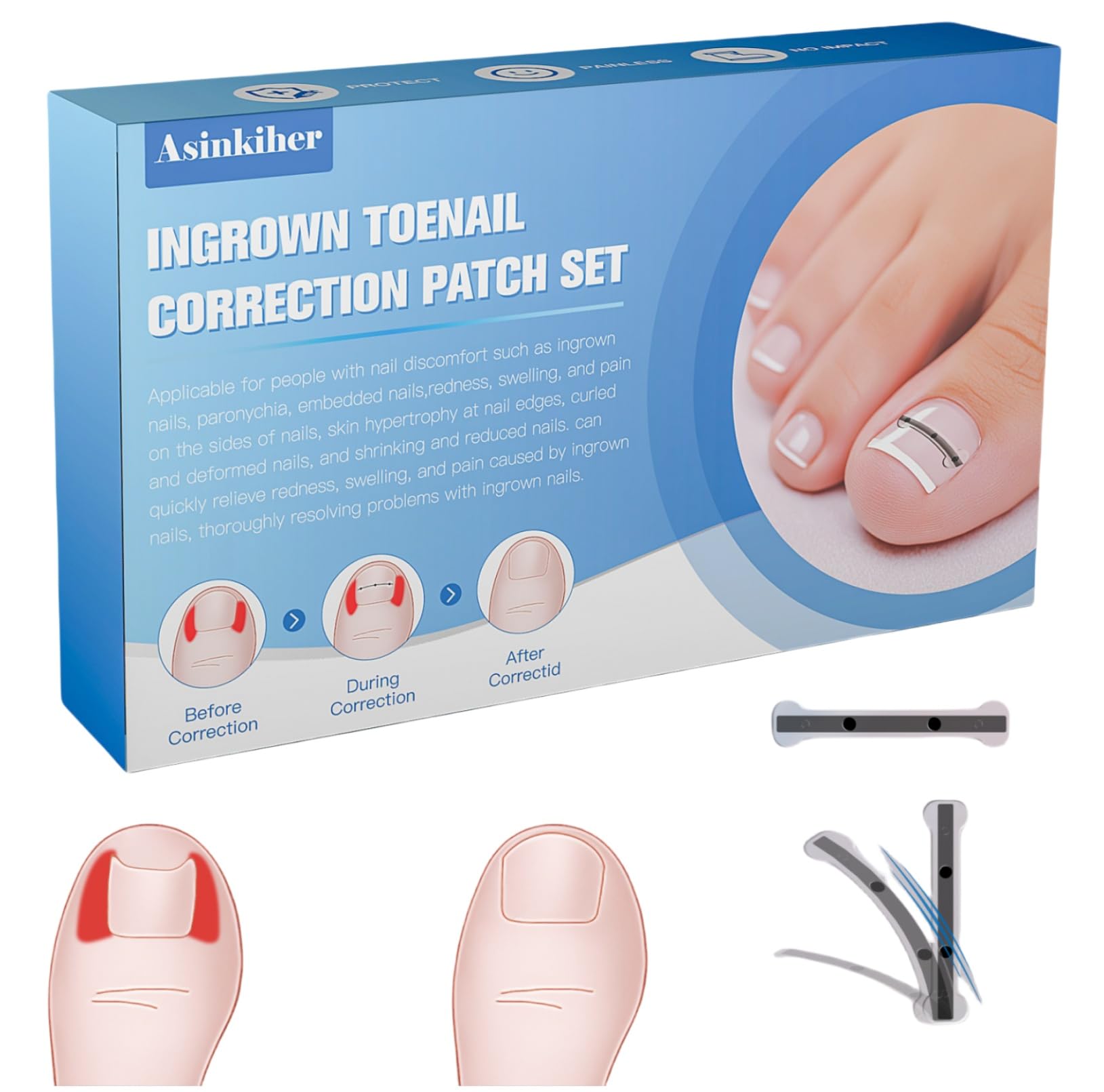 asinkiher titanium alloy memory-function corrector shows precise nail realignment for comfortable wear.