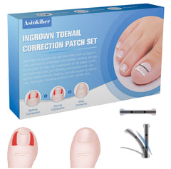 asinkiher titanium alloy memory-function corrector shows precise nail realignment for comfortable wear.