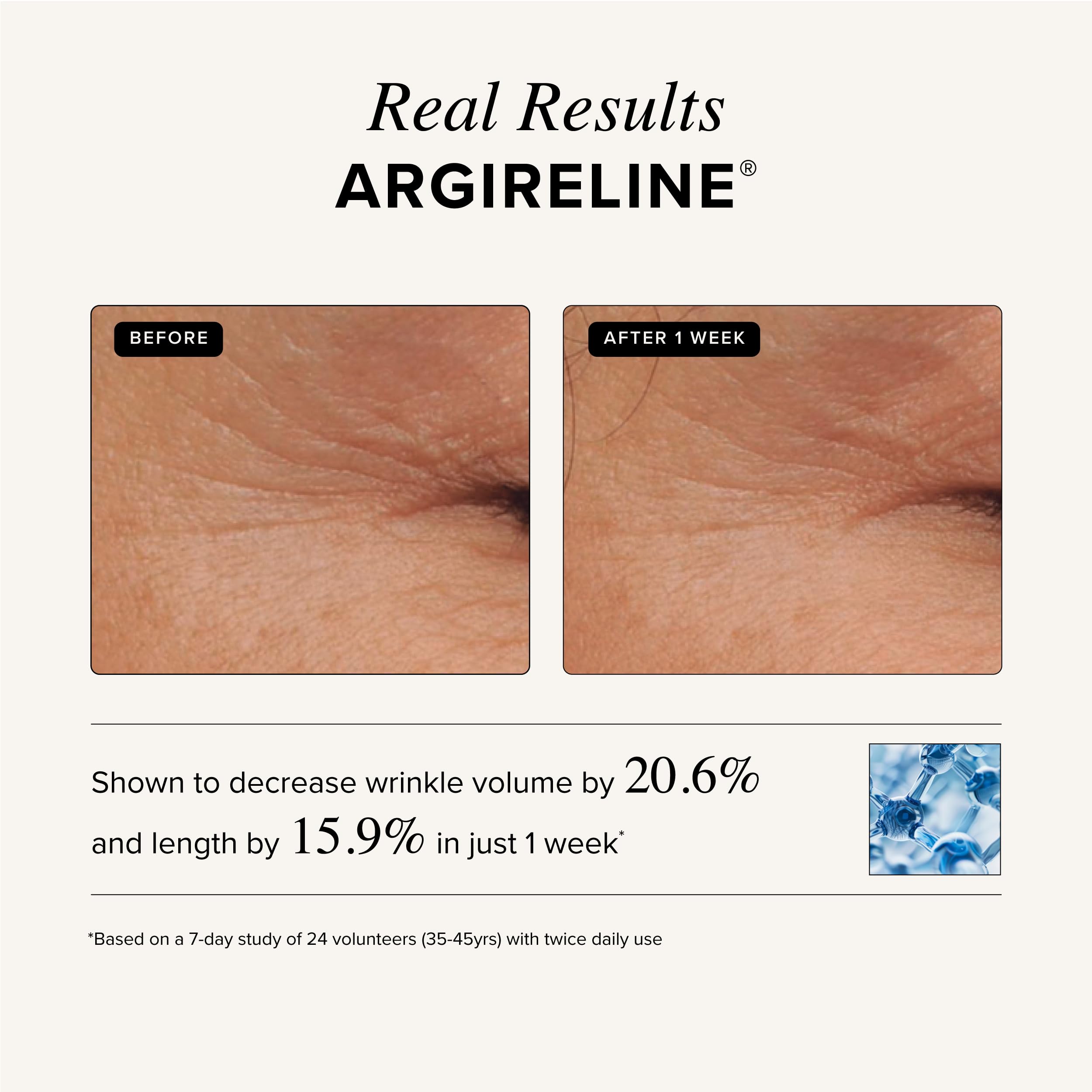 Asterwood Argireline Serum dropper releasing clear serum for hydrated skin.