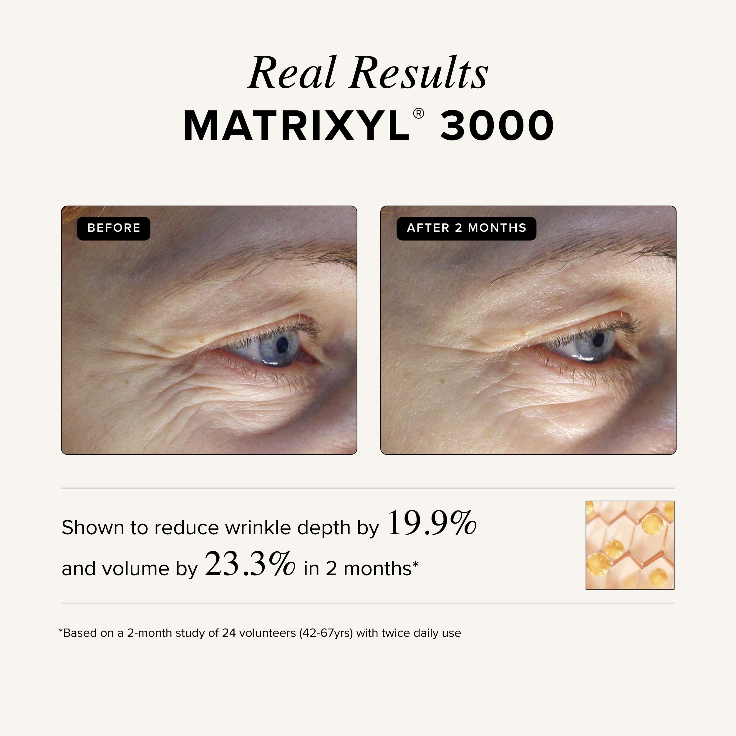 Asterwood hyaluronic acid hydration graphic illustrates moisture support.