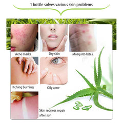 ASYBO gel aloe vera para cabello, reparación suave y brillo