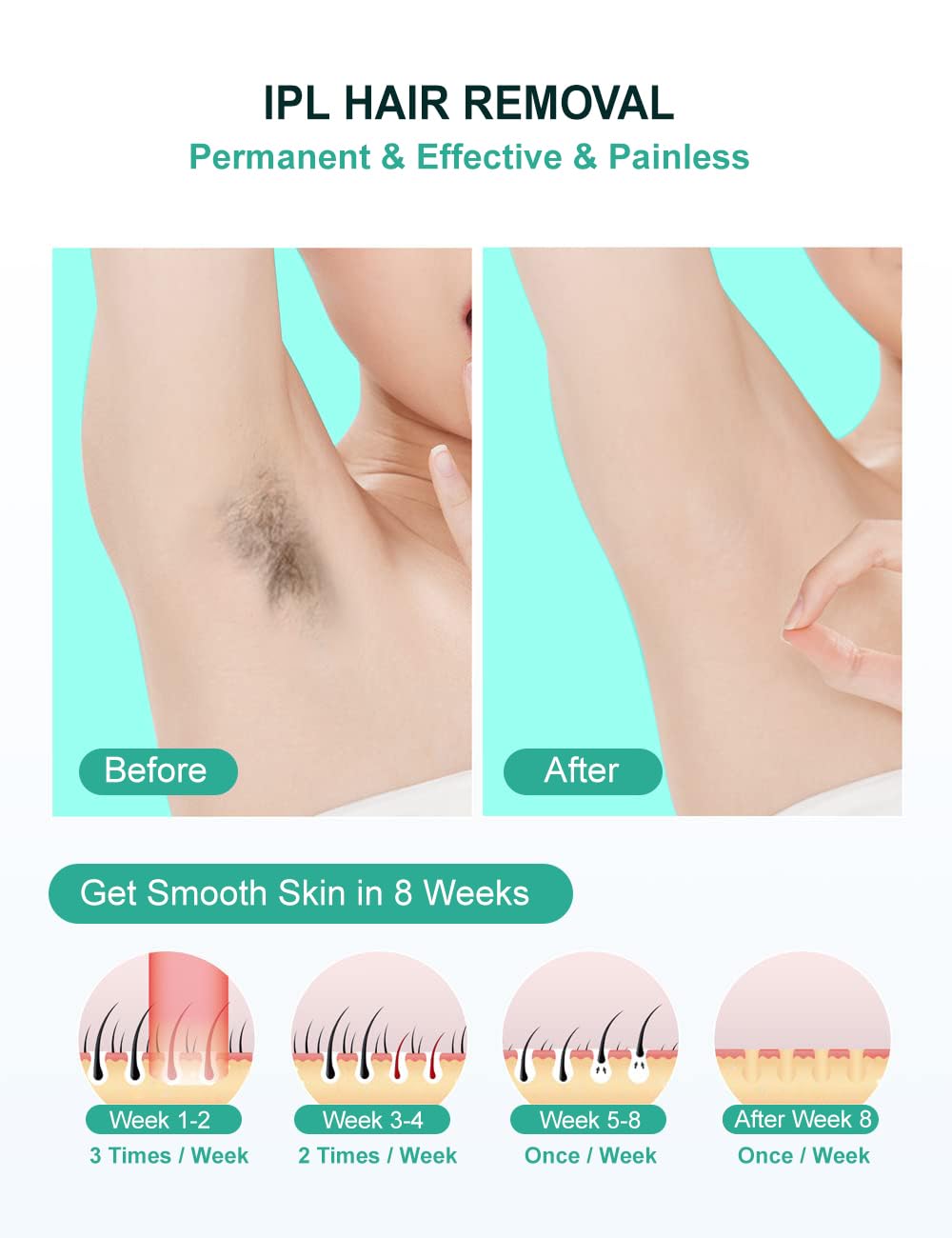 AUITRONCARE IPL device in hand for easy manual treatment