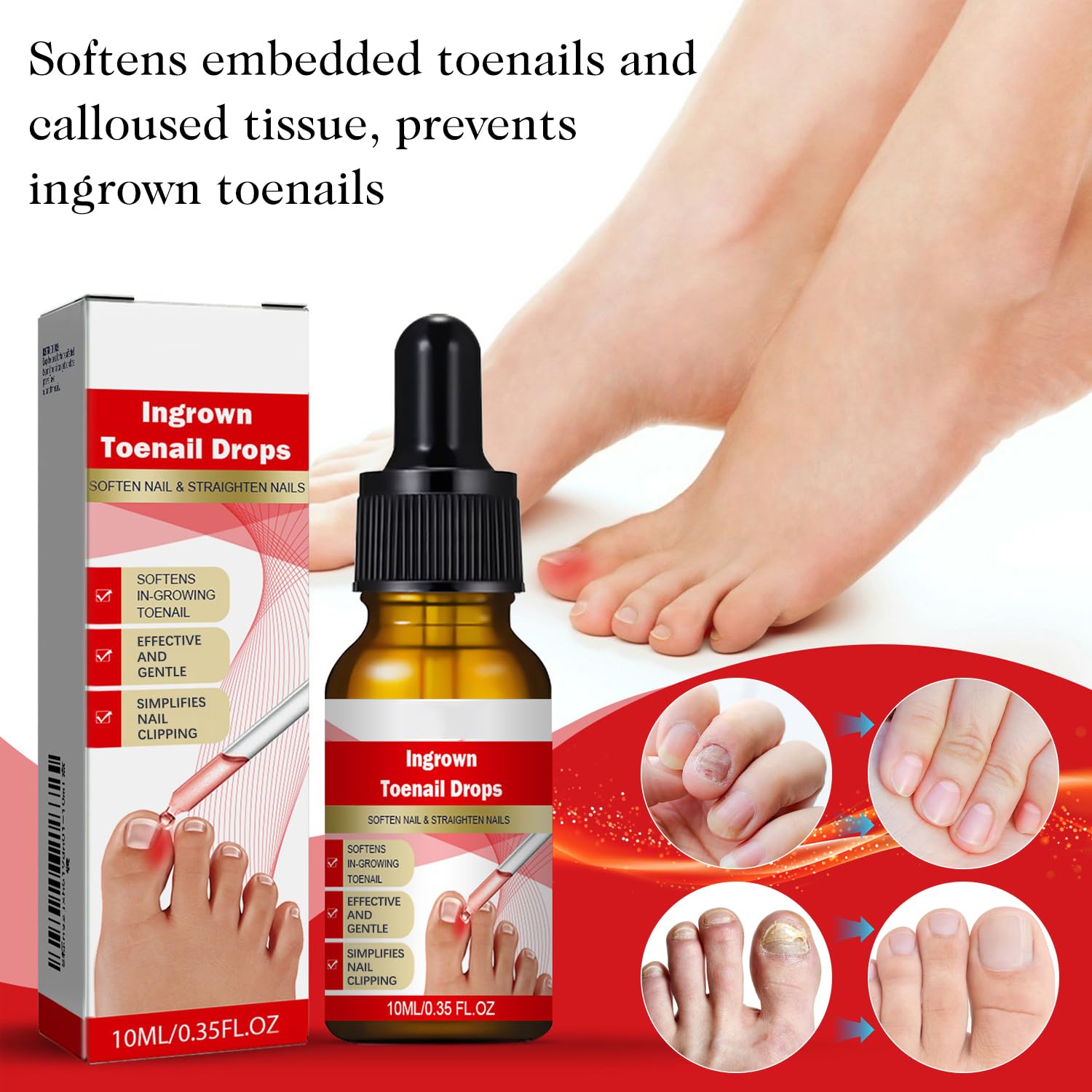 AUJ ingrown toenail drops application brush enables precise use.