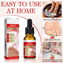 AUJ silicone gel toe caps shown for protective fitting.