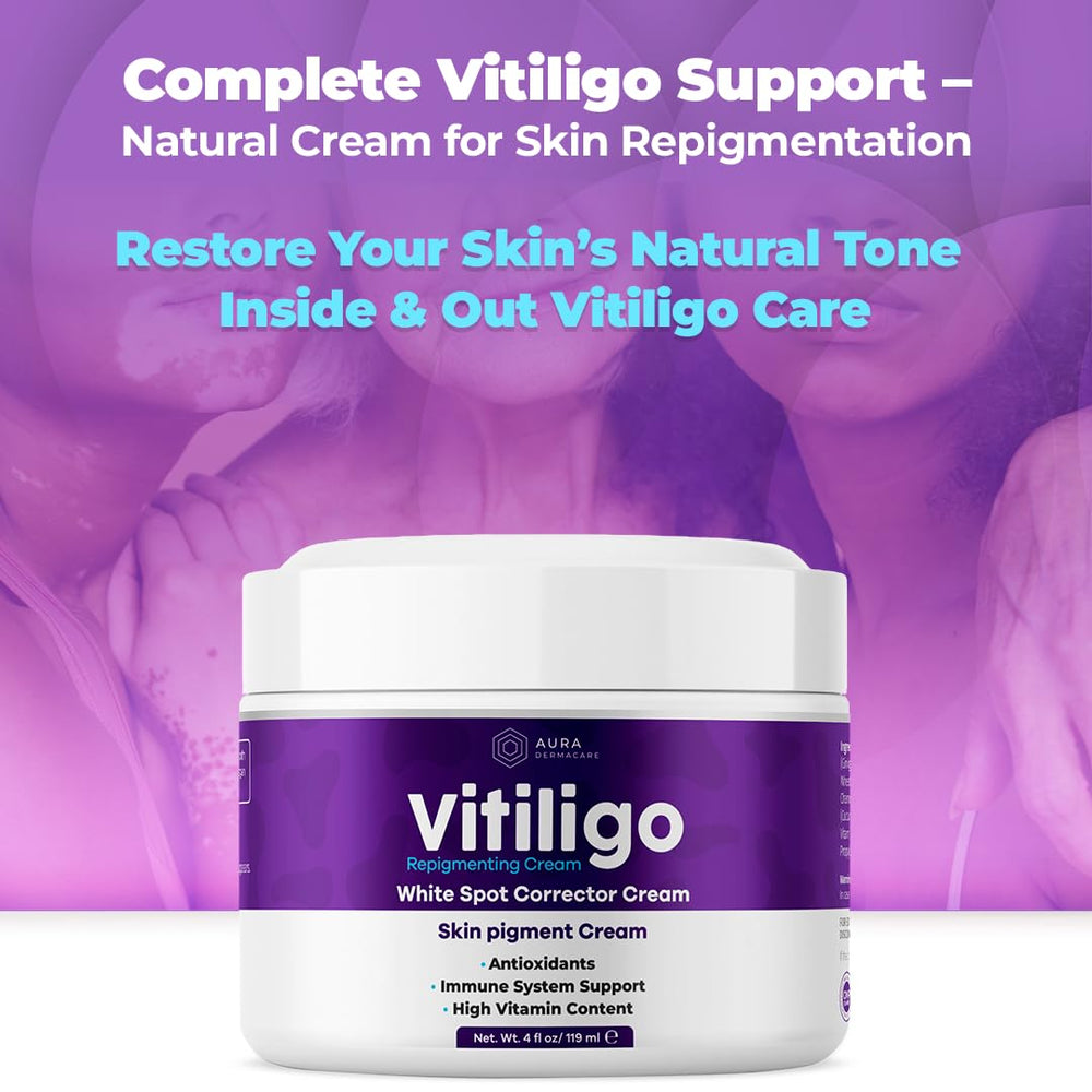 Aura Dermacare Vitiligo Cream on skin demonstrates potential for even-tone results.