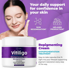 Aura Dermacare Vitiligo Cream texture close-up on skin highlights smooth absorption.