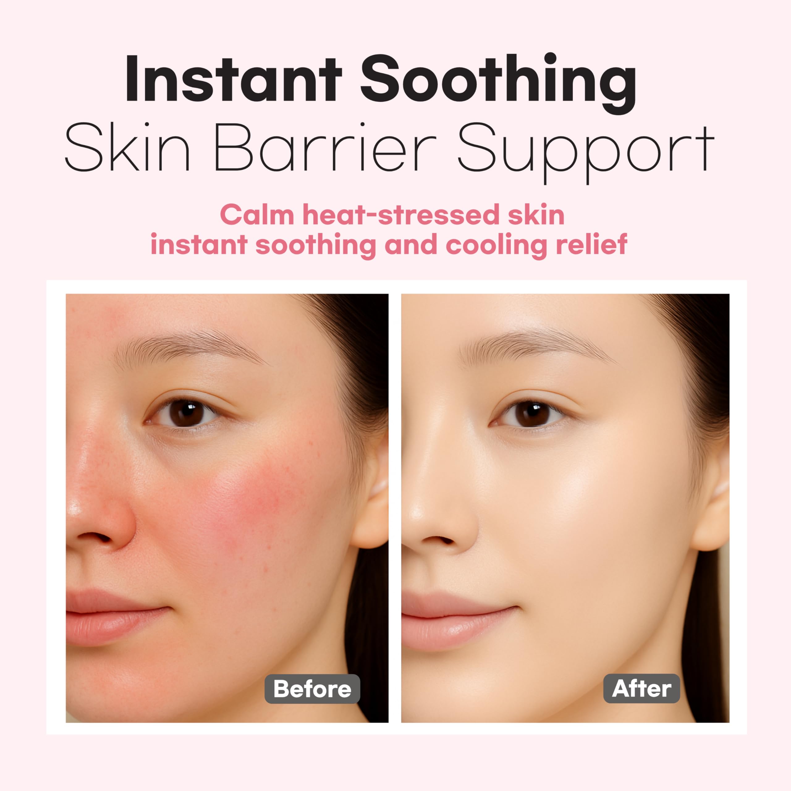 aurtier Cica soothing mist on skin showing calming relief and barrier support.