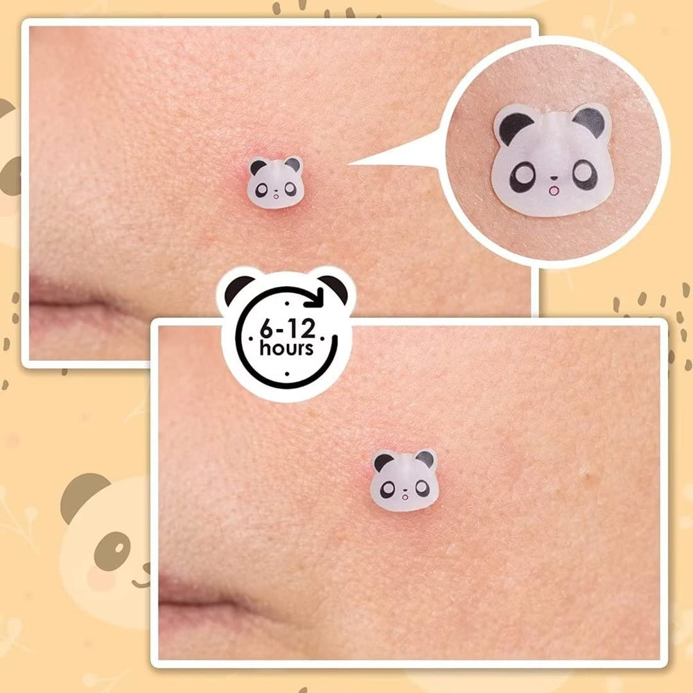 AUSLKA Panda Patch protección ligera, evita tocar la imperfección