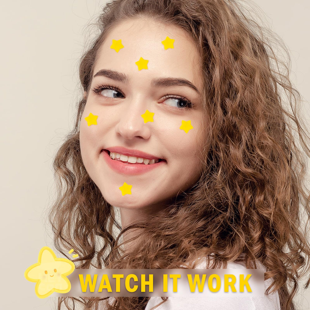 AUSLKA Star Pimple Patches on-face demo highlights comfortable, barely-there wear.