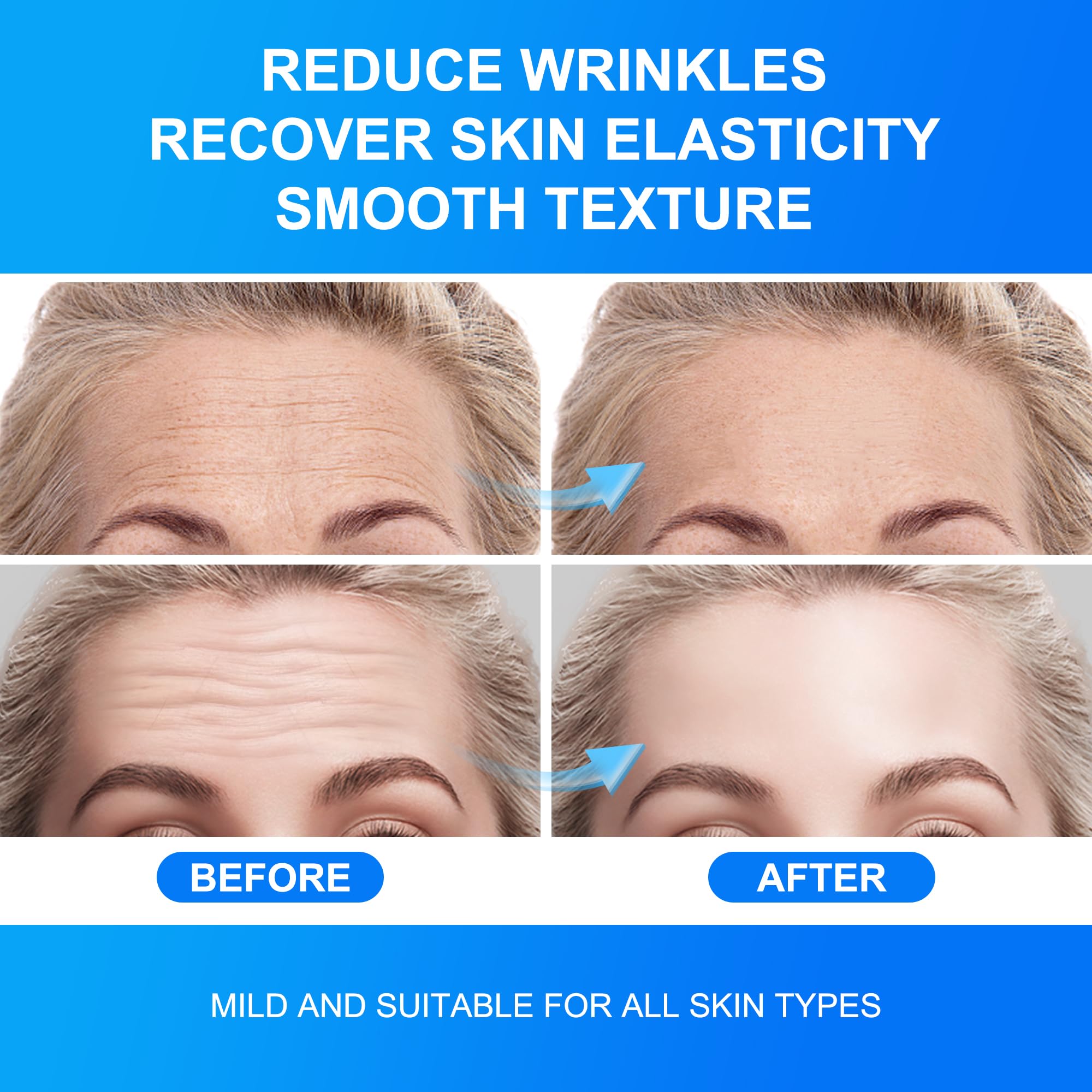 Auteek Forehead Wrinkle Patches travel-friendly box supports convenient self-care anywhere.