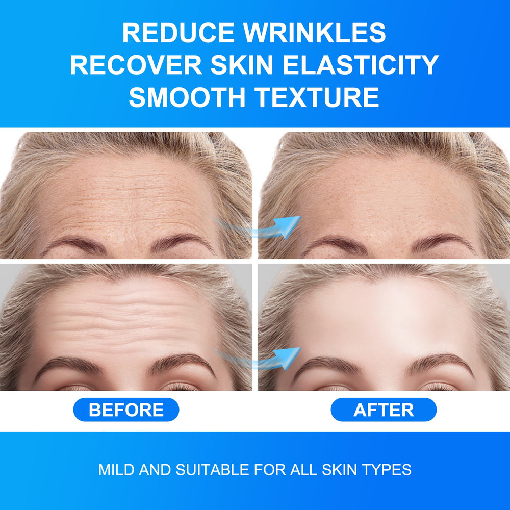 Auteek Forehead Wrinkle Patches travel-friendly box supports convenient self-care anywhere.