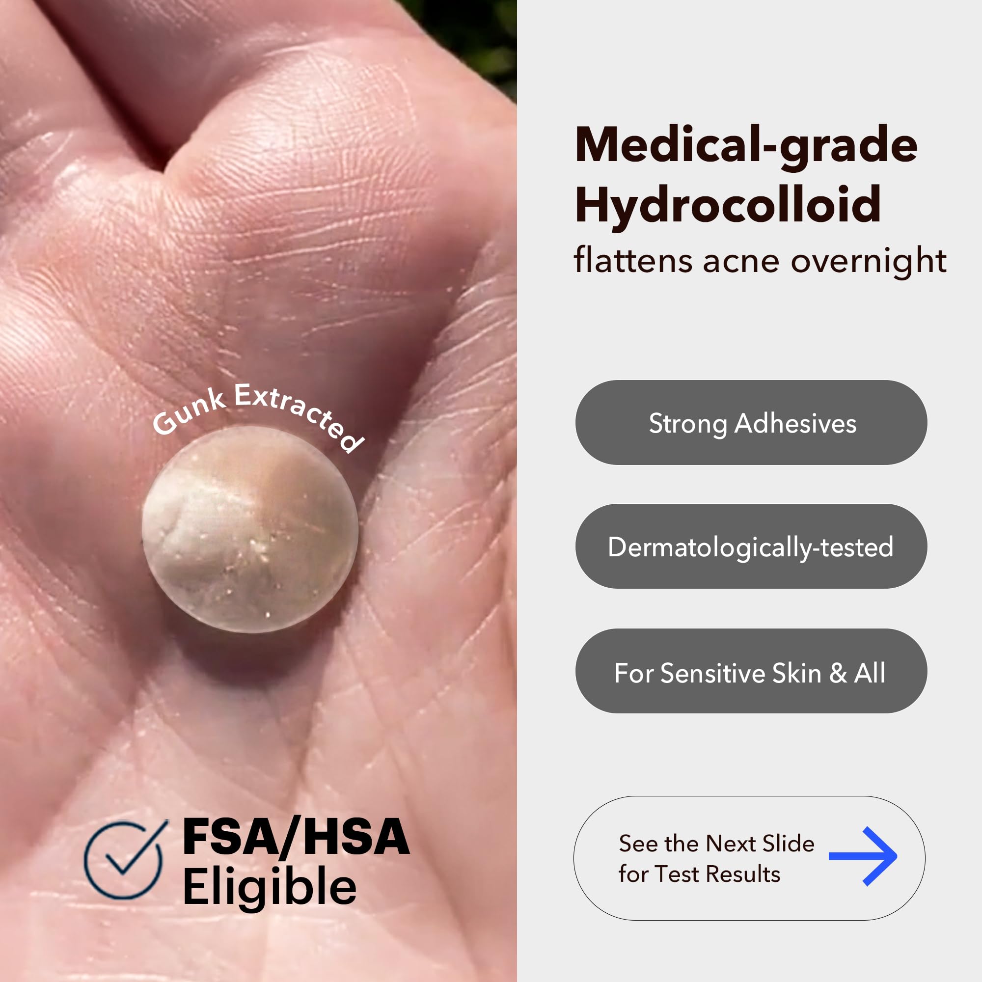 AVARELLE hydrocolloid patch blends with skin for day-long discretion.