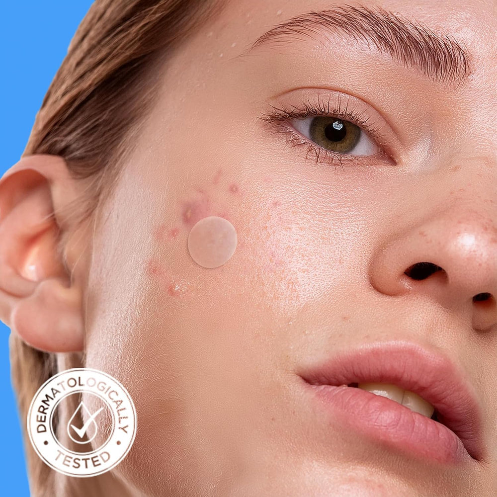 AVARELLE pimple patch with Calendula calms and protects blemishes.