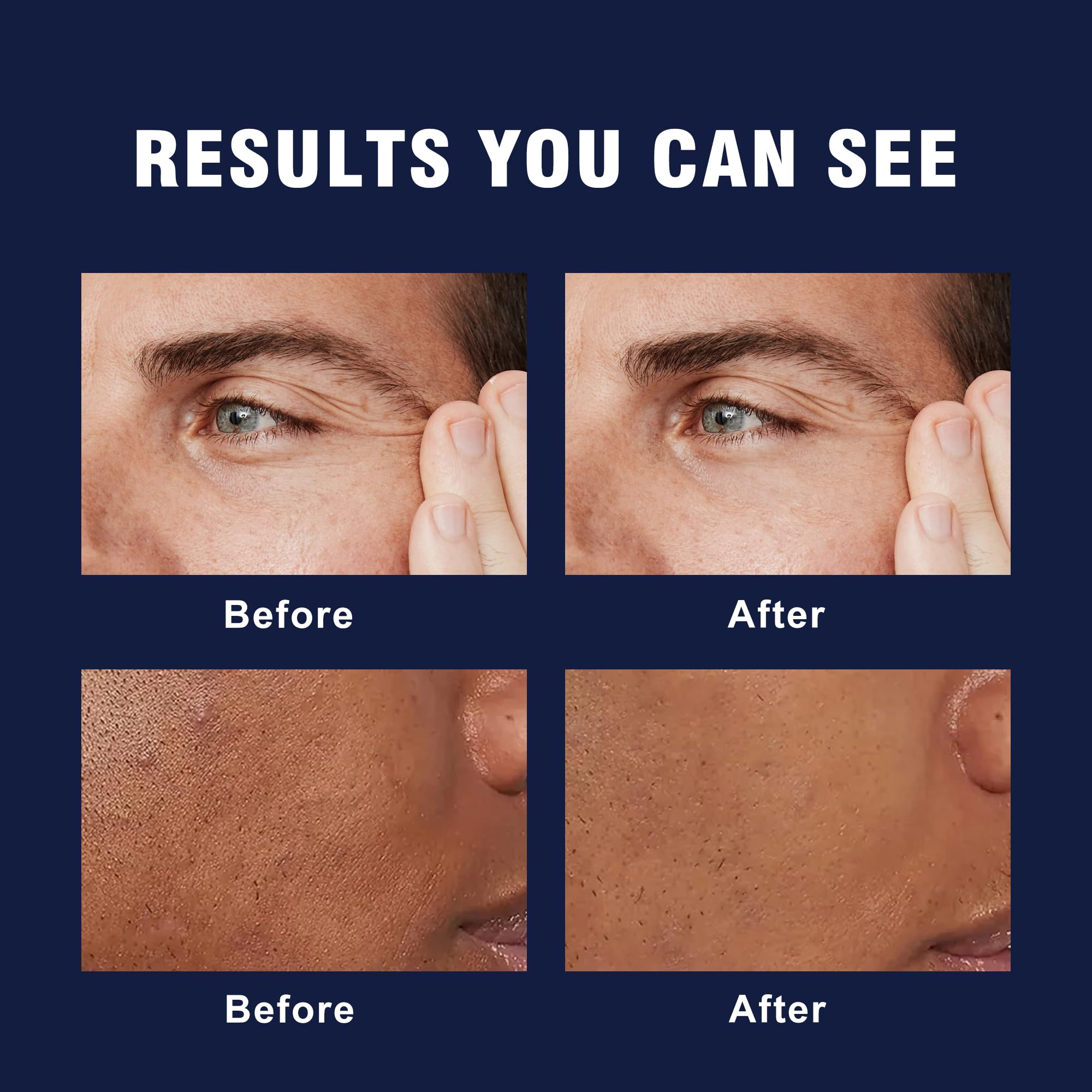 AVITAPURE 6-in-1 facial cream on man's skin, suggesting a refreshed look.