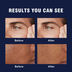 AVITAPURE 6-in-1 facial cream on man's skin, suggesting a refreshed look.