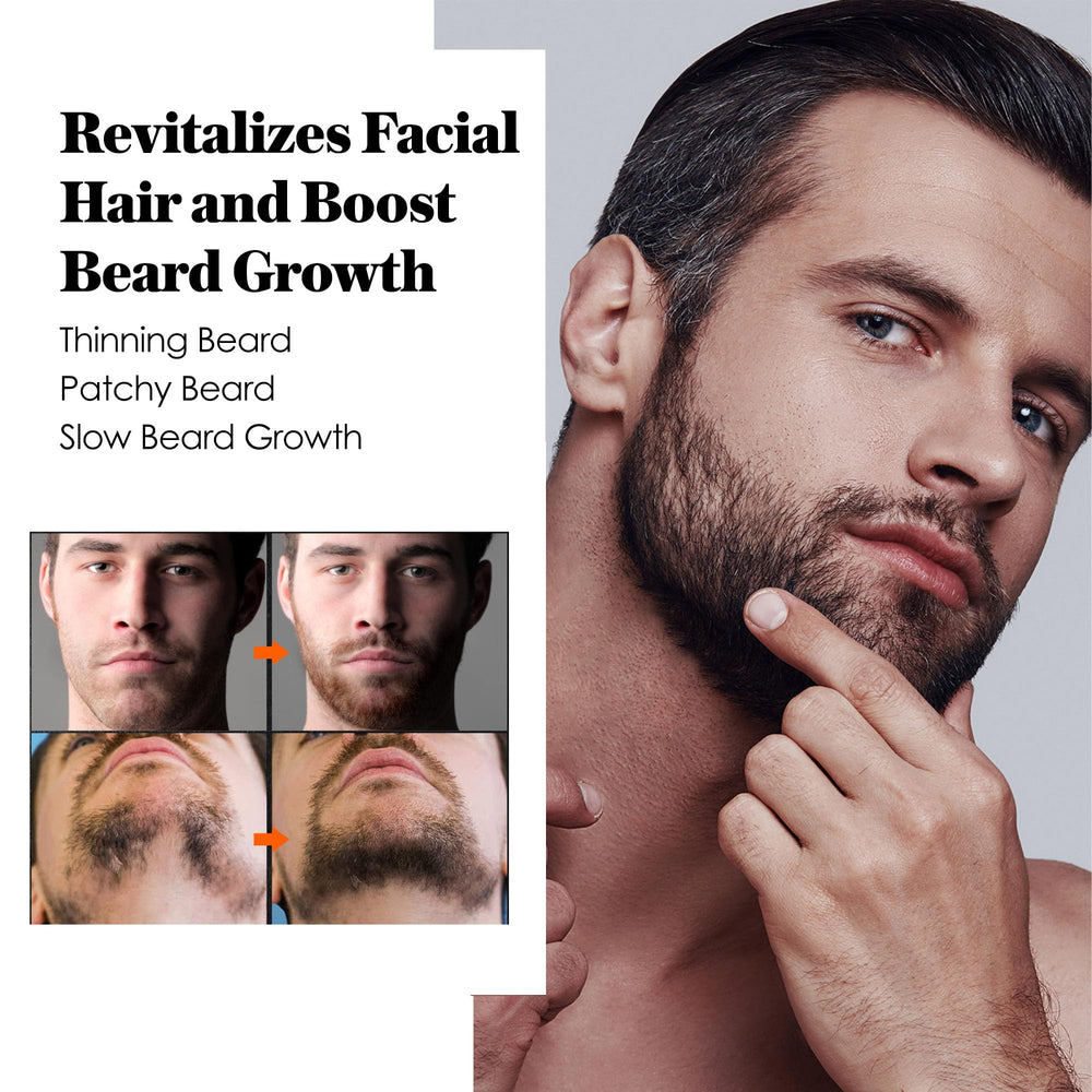 AVITAPURE minoxidil beard growth oil packaging close-up highlighting nourishing formula