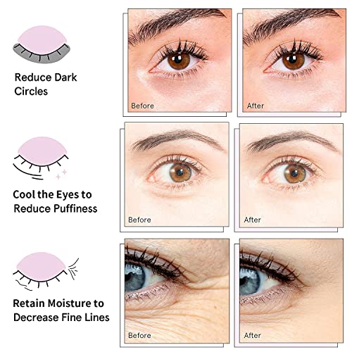 AVJONE 24K Gold Under Eye Patches application scene for puffiness relief