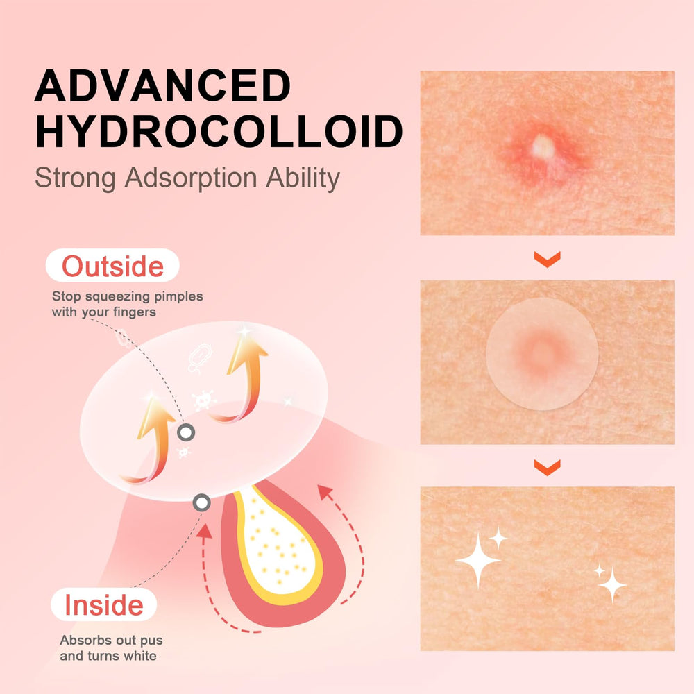 AVJONE Pimple Patches with tea tree oil closeup for soothing blemishes.