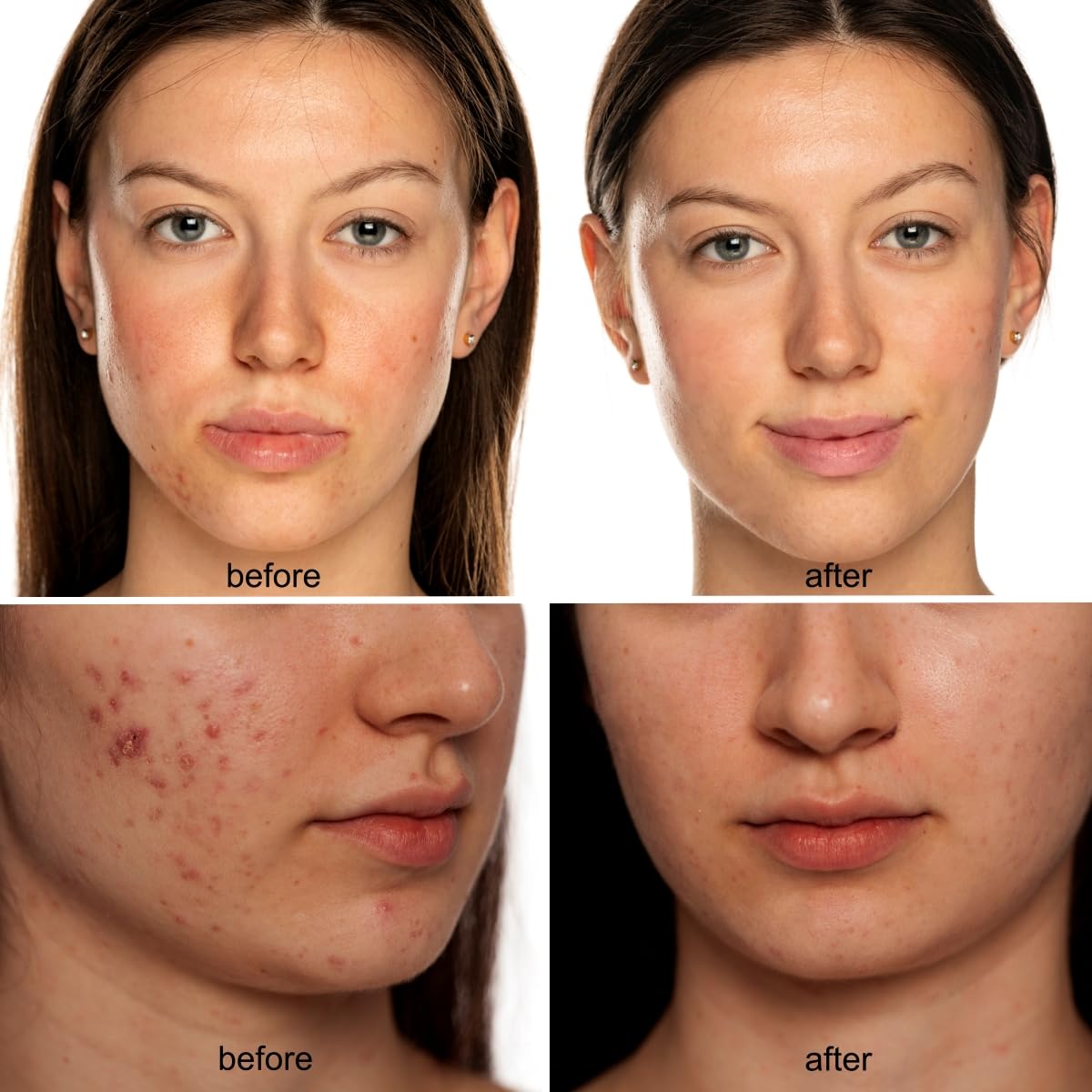 Avorla Beauty LED mask on-face fit demonstrates contour-friendly coverage