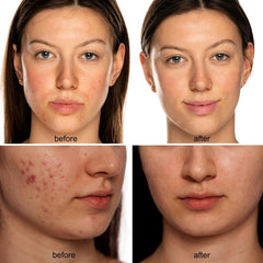 Avorla Beauty LED mask on-face fit demonstrates contour-friendly coverage