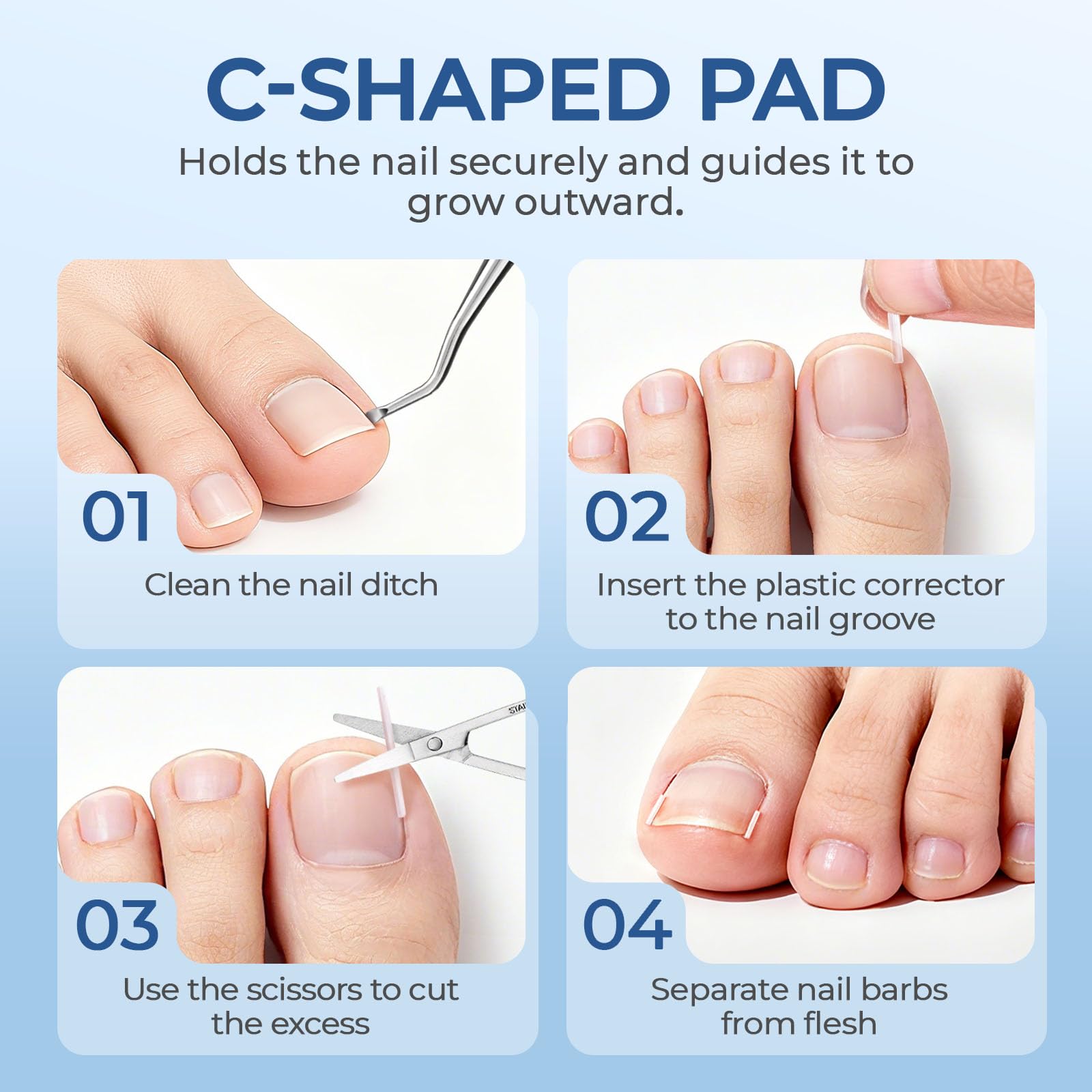 awrose gel correction strips flexible to fit under nail edge for trim-friendly use