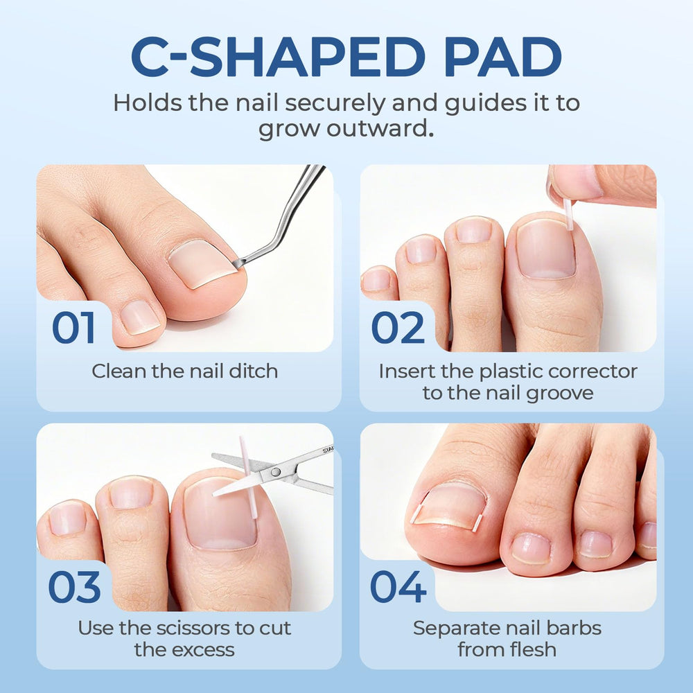 awrose gel correction strips flexible to fit under nail edge for trim-friendly use