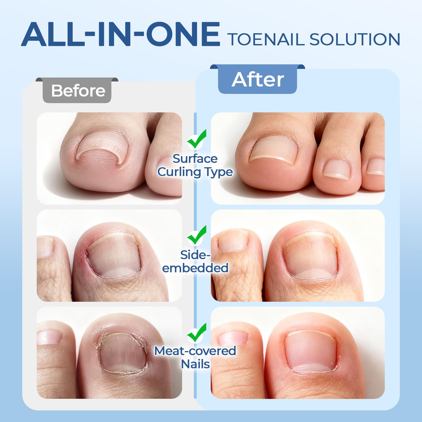 awrose cuticle pushers and tools for precise nail groove cleaning