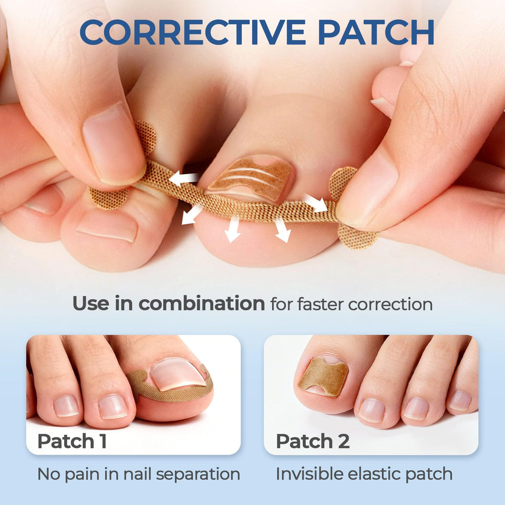 awrose i-shaped correction stickers close-up gentle nail contour support