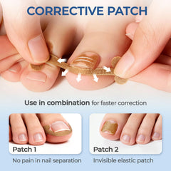 awrose i-shaped correction stickers close-up gentle nail contour support