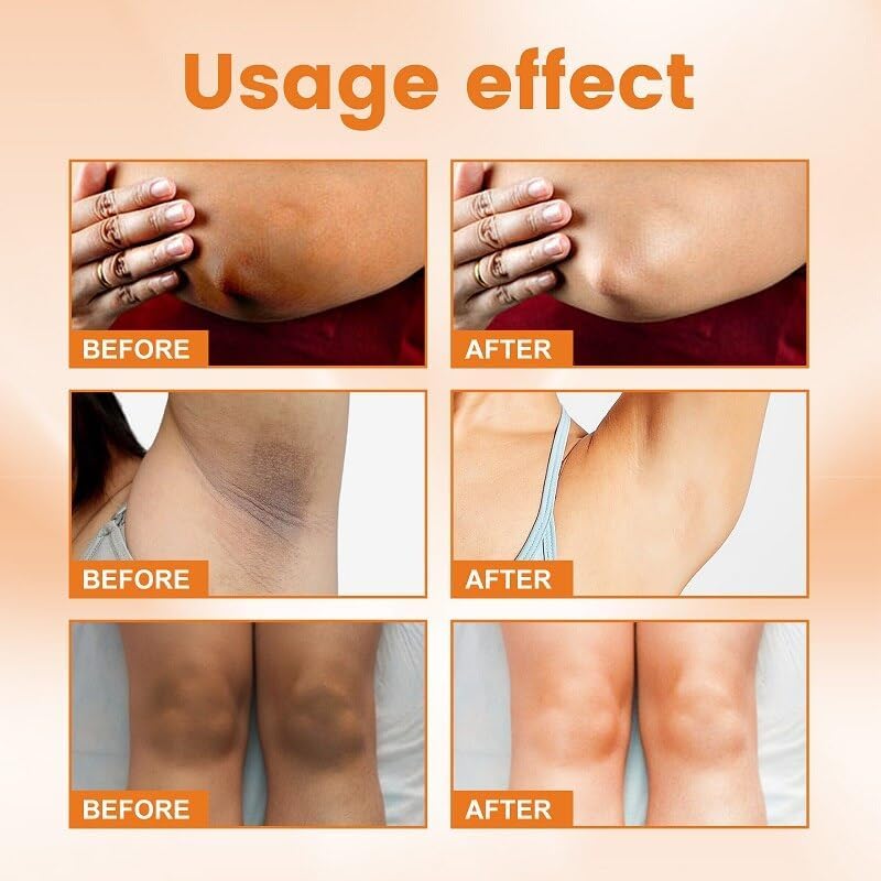 Axnoocy VVhitening cream for elbows and knees, smooths dry patches