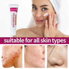 Azelaic acid cream being applied gently supports daily skincare routine.