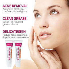 Azelaic acid cream swatch on skin demonstrates even tone potential.