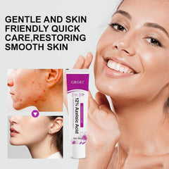 Azelaic acid cream tube closeup shows smooth texture for facial care.