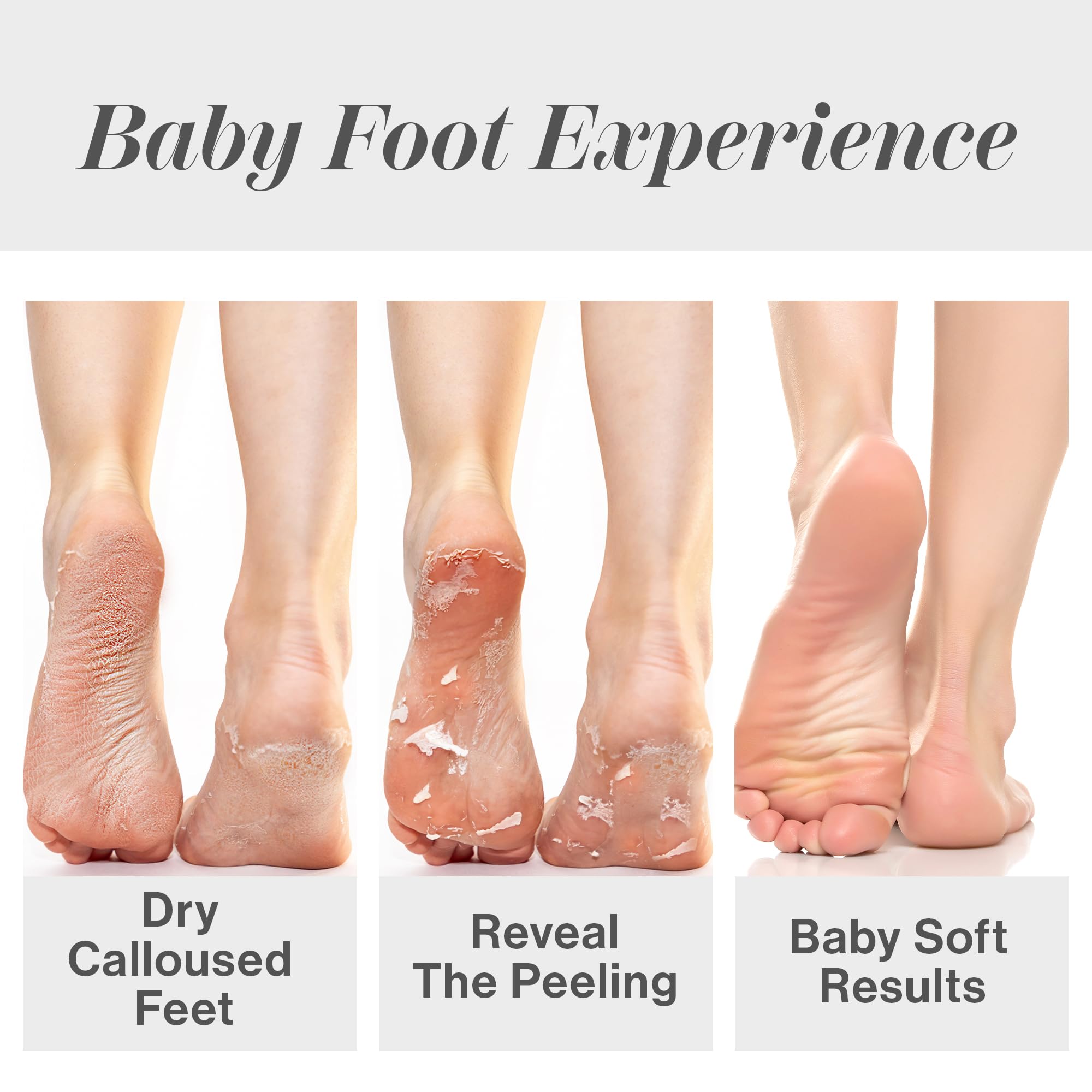 Baby Foot at-home spa setup invites a relaxing, hour-long foot care session.