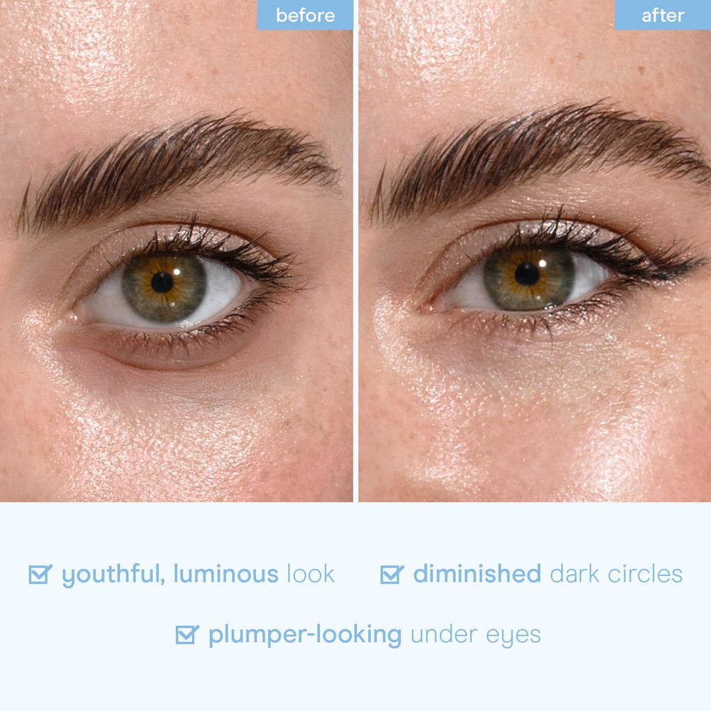 Baebody depuffing patches after late-night use for refreshed eyes