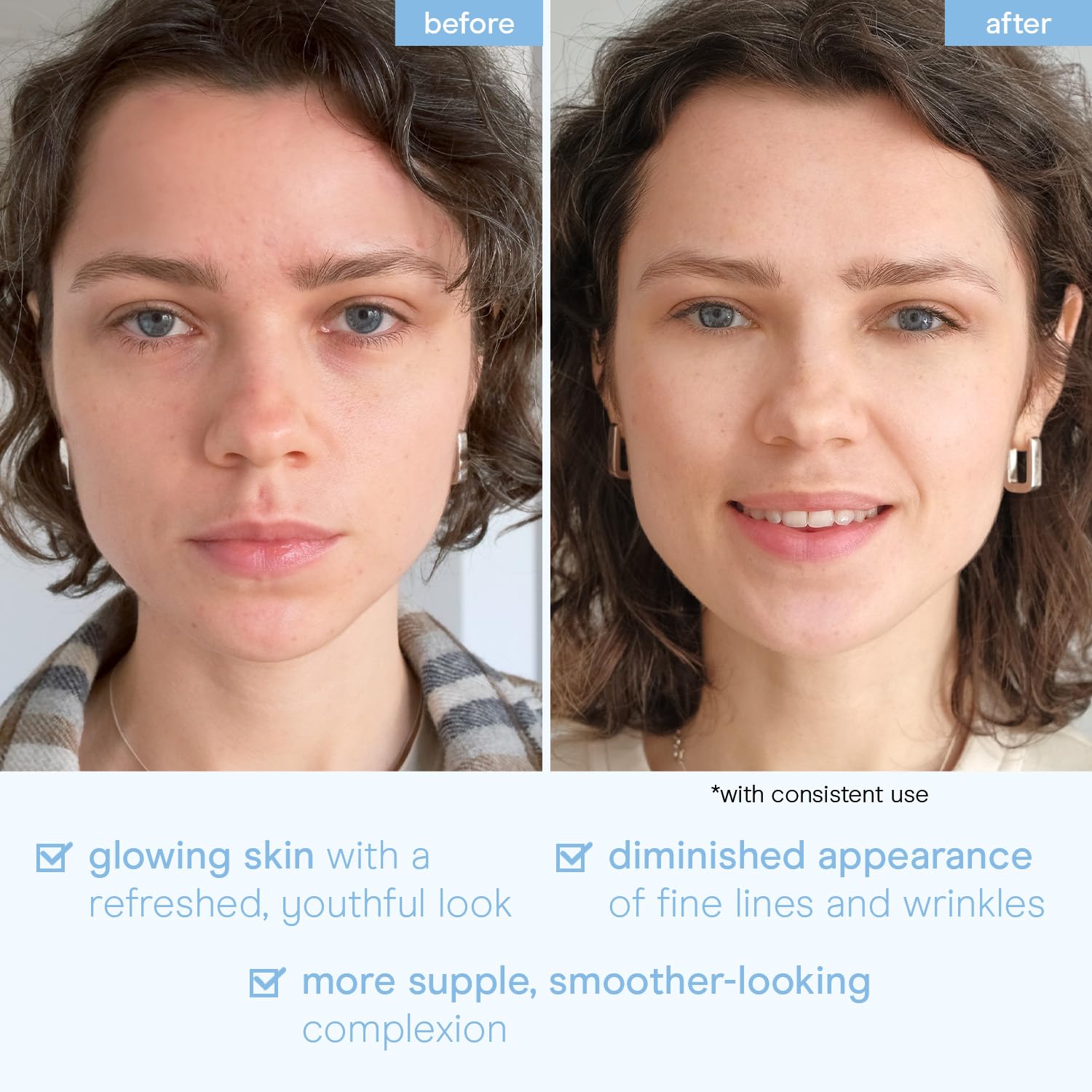 Baebody Snail Mucin Mask applied on face for a cooling, refreshing treatment.