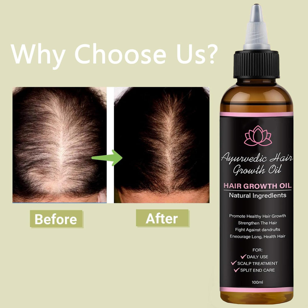BALPPRD Lifewitqueenp oil dropper dispensing for easy, lightweight application.