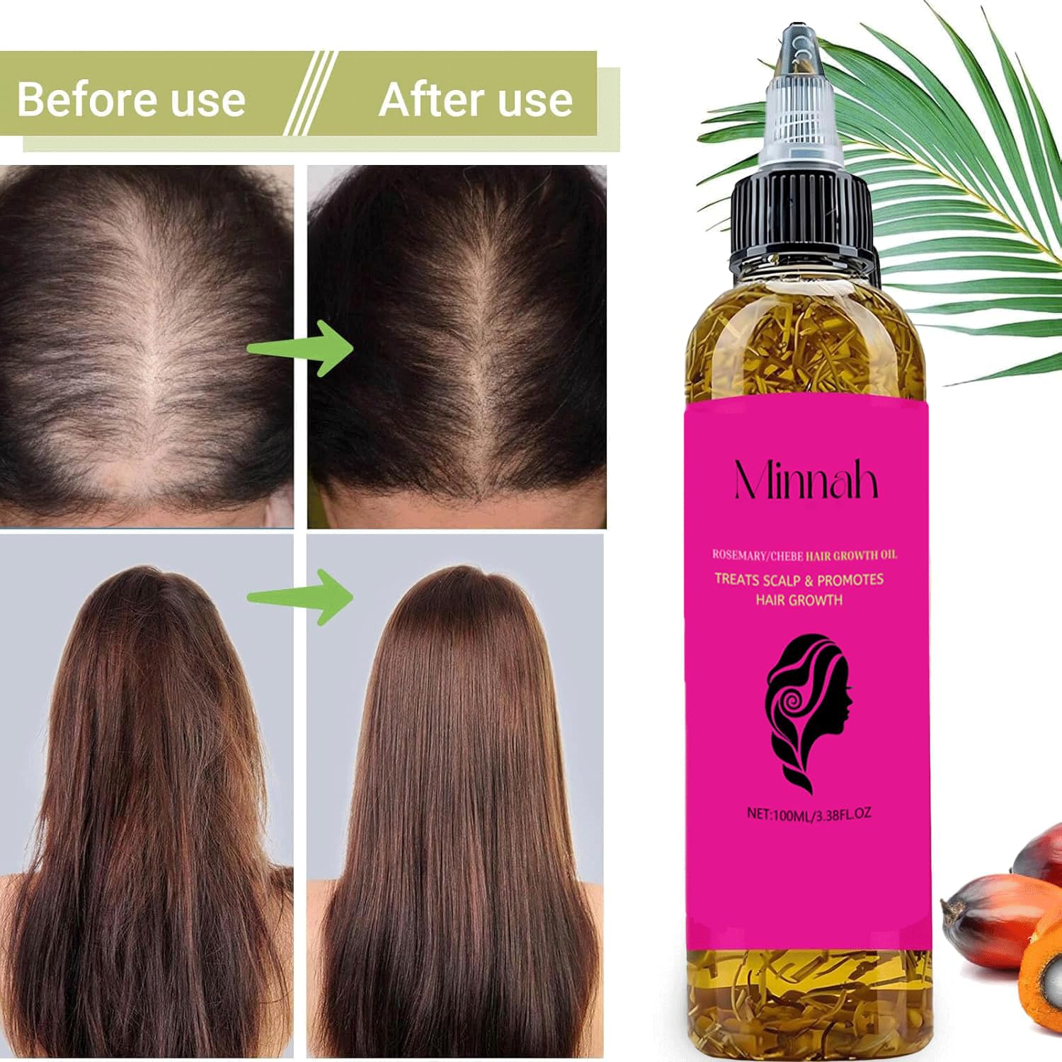 BALPPRD Minnah Batana Oil 4-in-1 blend supports versatile hair care.