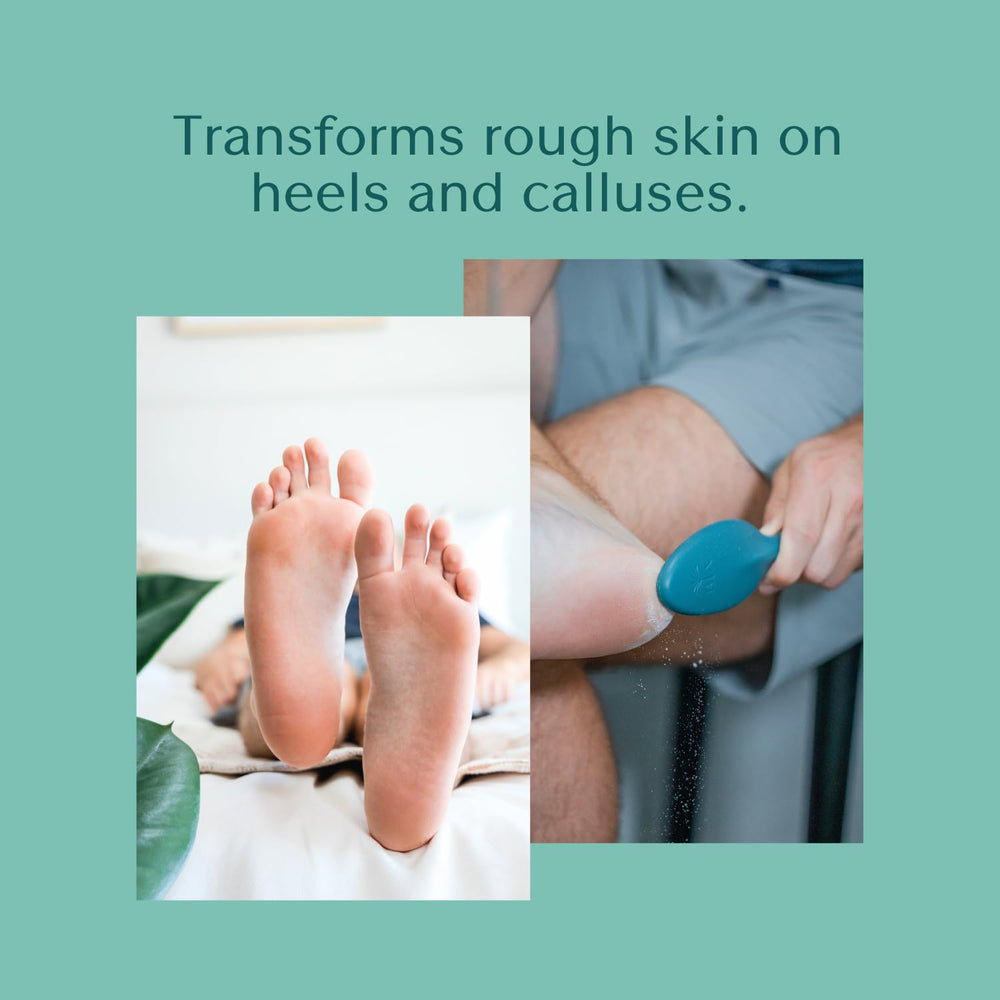 Bare August foot callus remover teal in hands demonstrating effective dead skin buffing