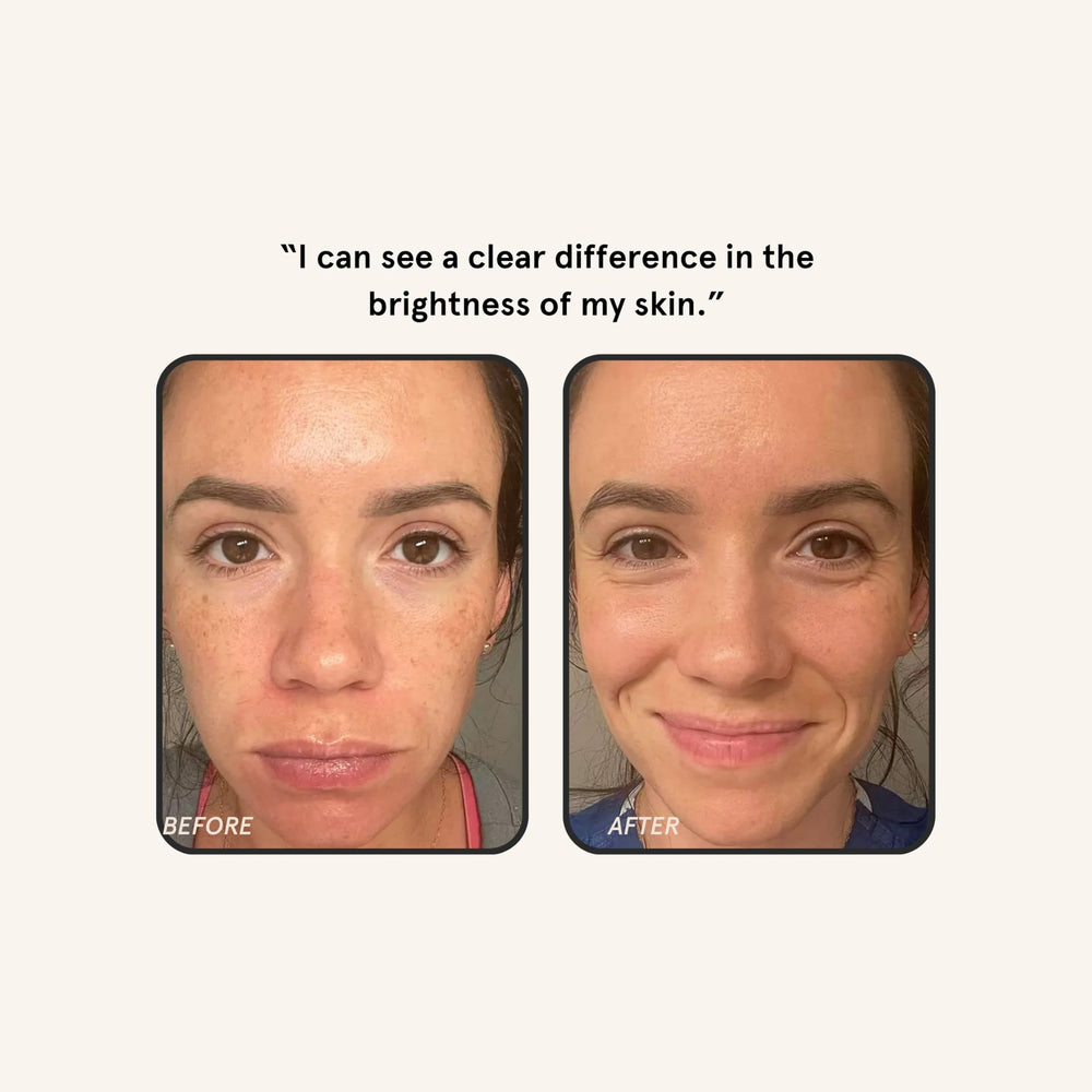 Barefaced Liquid Gold serum near dark spots for brightening potential.